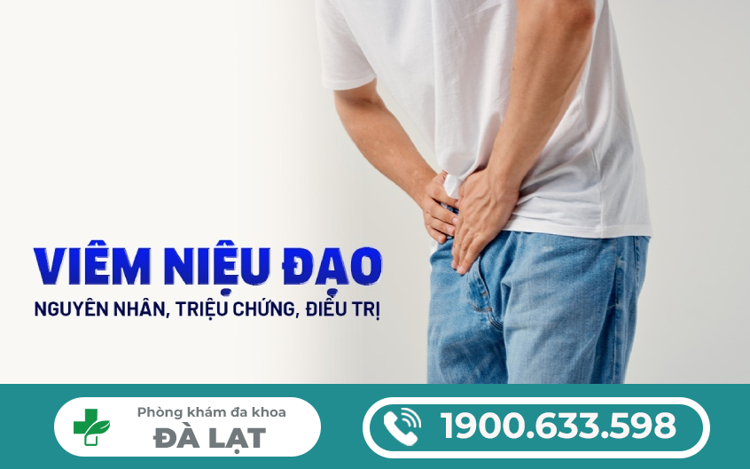Hình ảnh minh họa